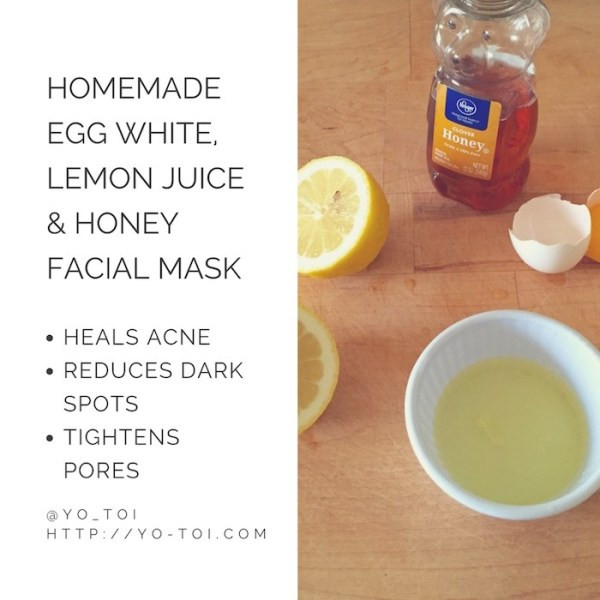 Acne Mask DIY
 Egg White Lemon Juice & Honey Facial Mask for Acne Scars