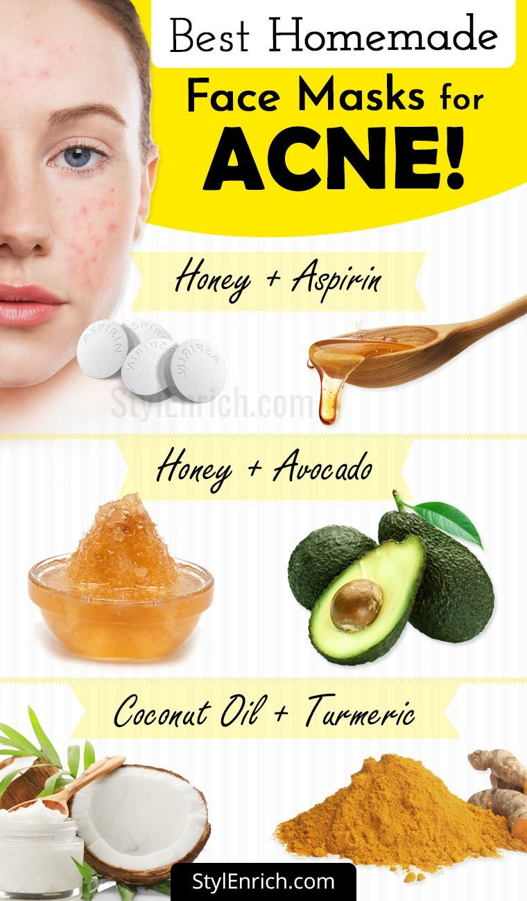 Acne Mask DIY
 Homemade Face Mask For Acne Treatment At Home