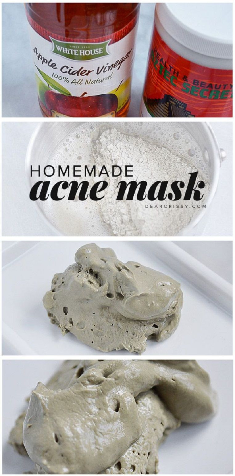 Acne Mask DIY
 DIY Acne Mask Recipe Unclogs pores and clears your skin