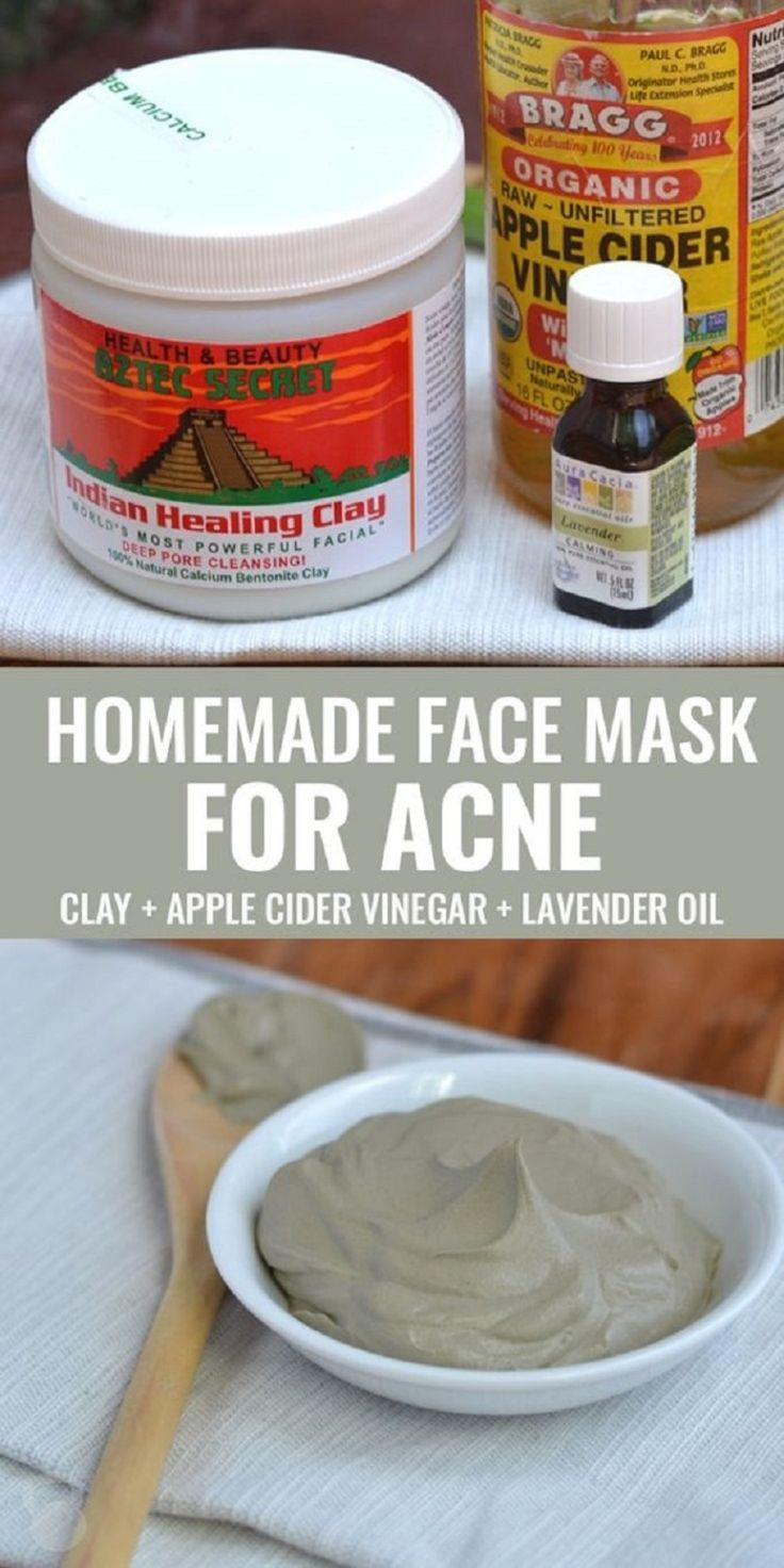 Acne Mask DIY
 25 beautiful Homemade acne mask ideas on Pinterest