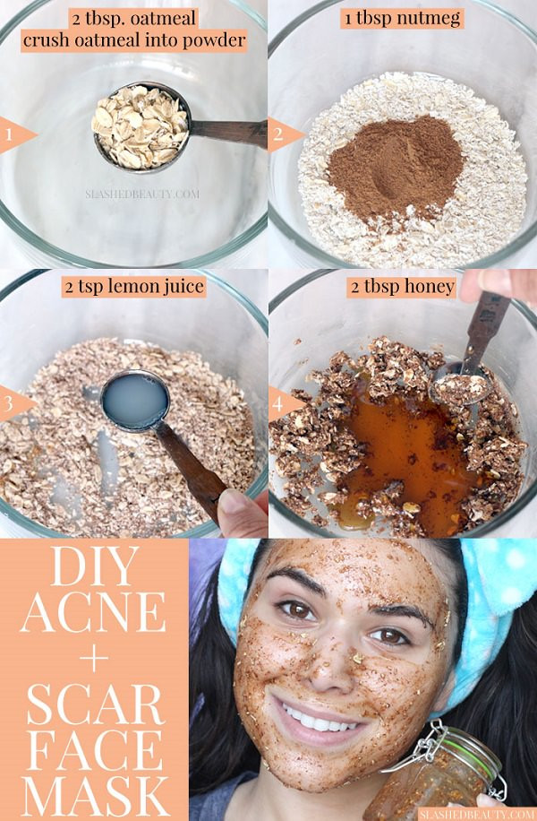 Acne Masks DIY
 Best DIY Face Mask for Acne & Acne Scars Honey & Nutmeg