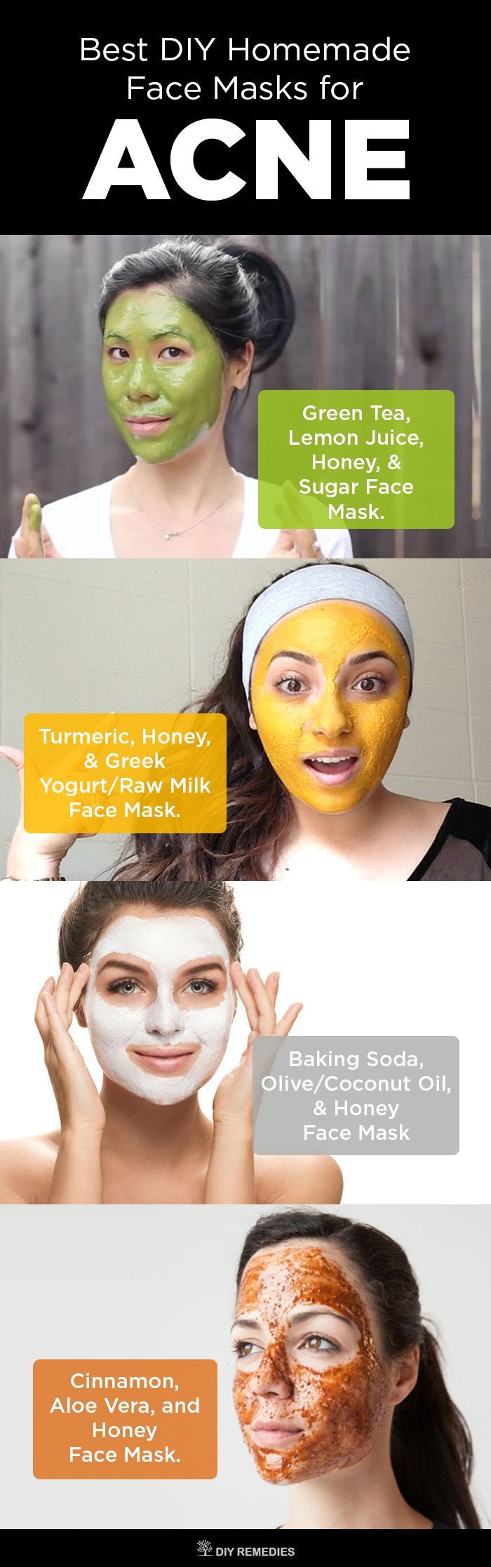 Acne Masks DIY
 6 Best DIY Homemade Face Masks for Acne