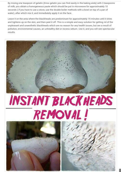 DIY Blackhead Mask
 1000 ideas about Natural Blackhead Remover on Pinterest