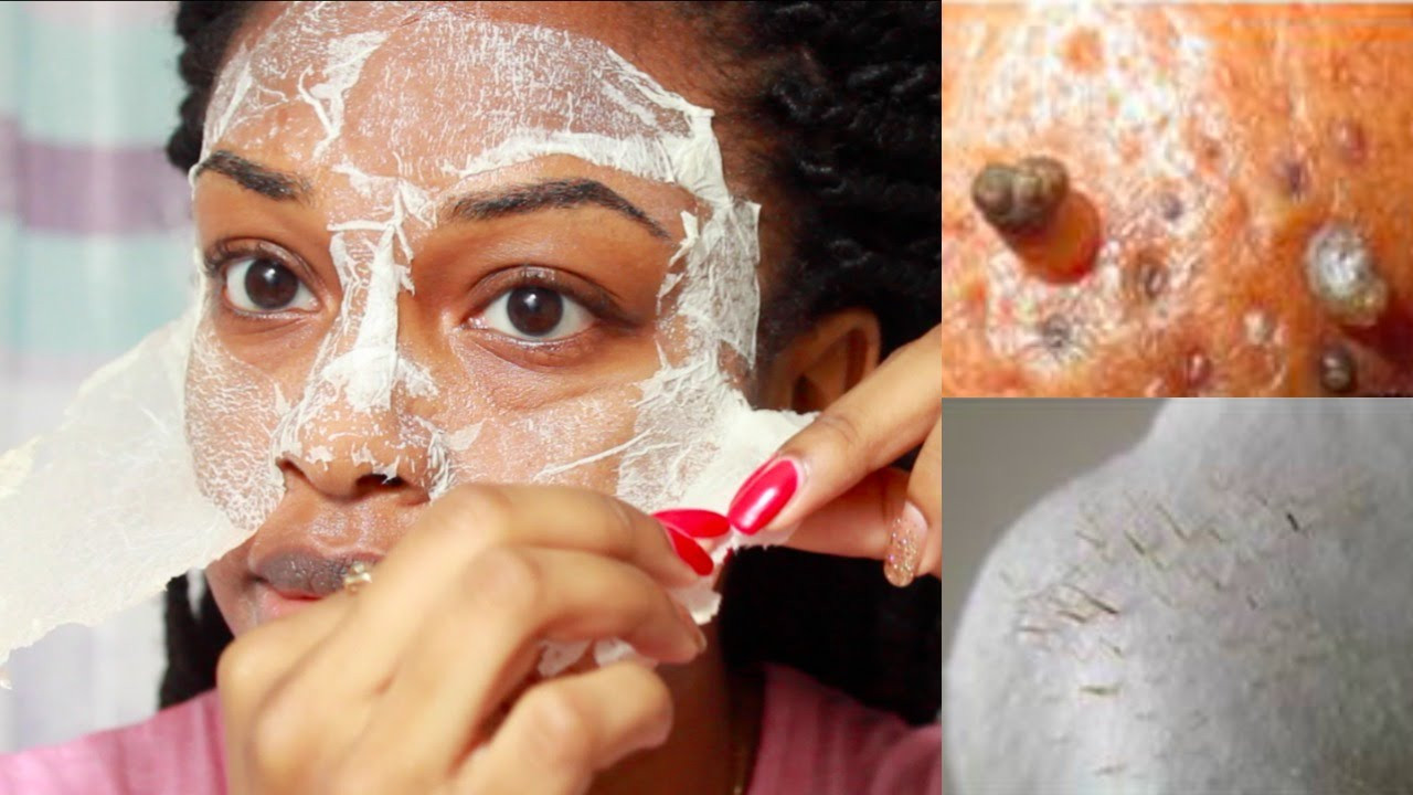DIY Egg White Peel Off Mask
 EASY DIY Egg Blackhead Remover Peel f Mask