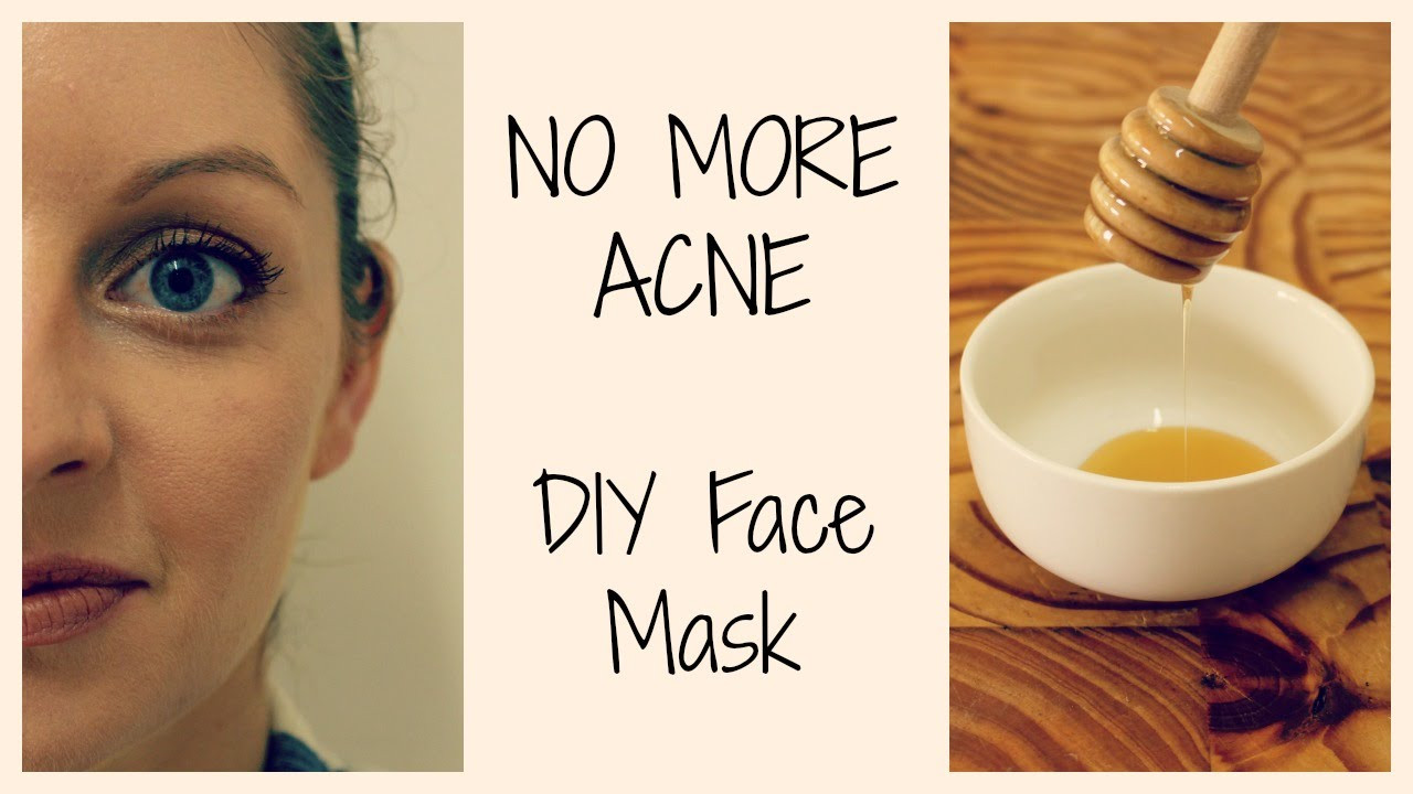 DIY Face Mask For Clear Skin
 HOW TO GET CLEAR ACNE FREE SKIN