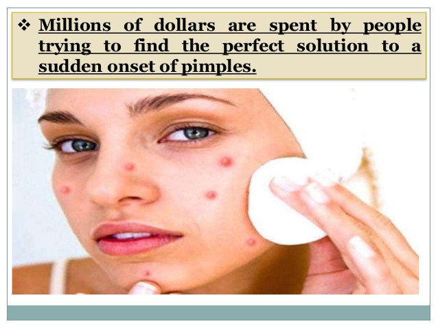 DIY Facemask For Pimples
 Homemade Face Mask Recipe For Acne