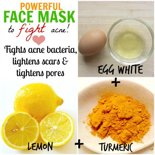 DIY Facemask For Pimples
 DIY Natural Homemade Face Masks for Acne Cure