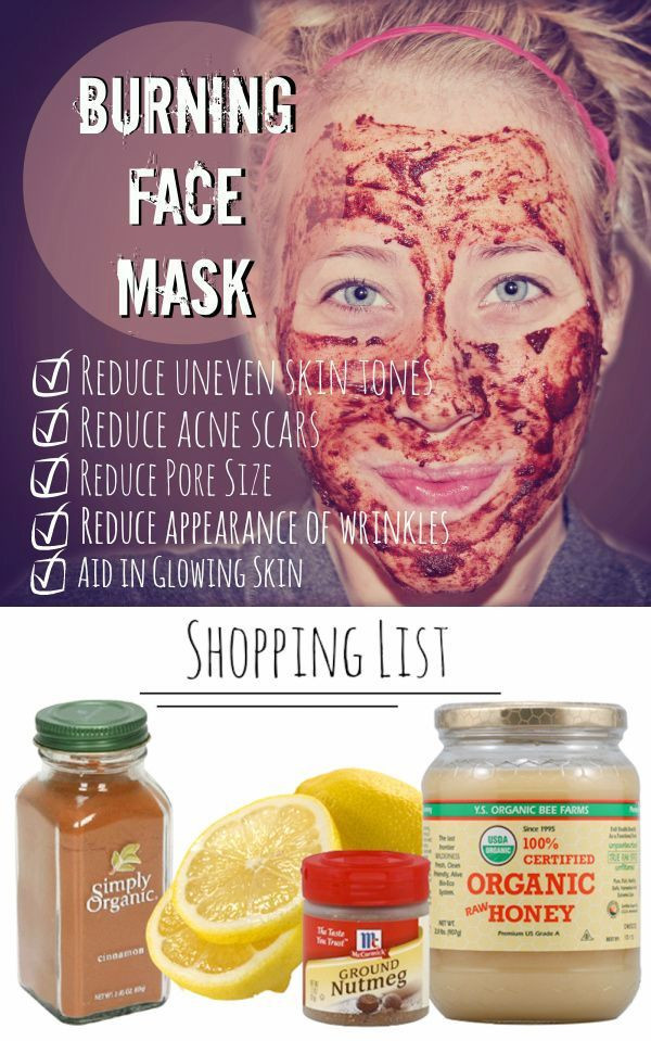 DIY Pimple Mask
 Acne Treatment Overnight Acne Treatment DIY Burning Face