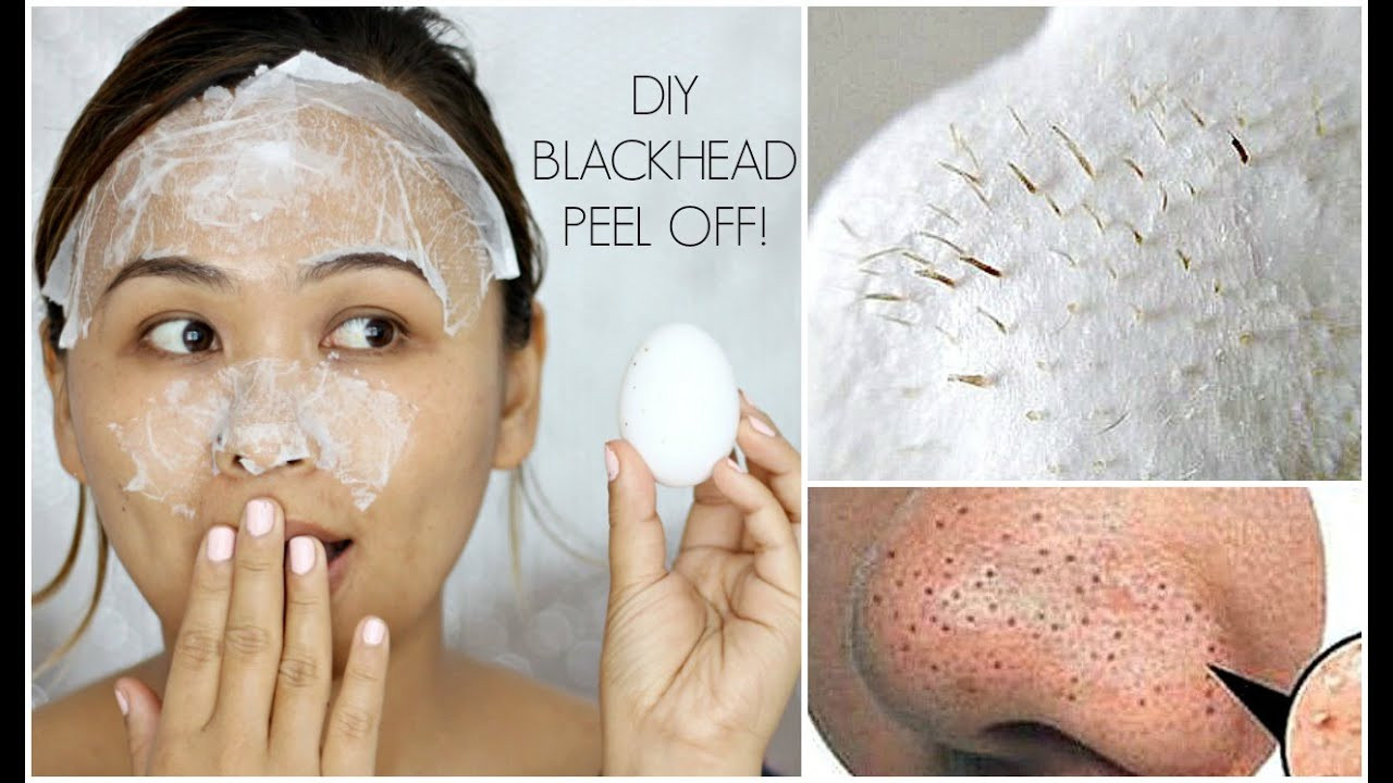 DIY Pimple Mask
 DIY Blackhead Peel f Mask with an Egg