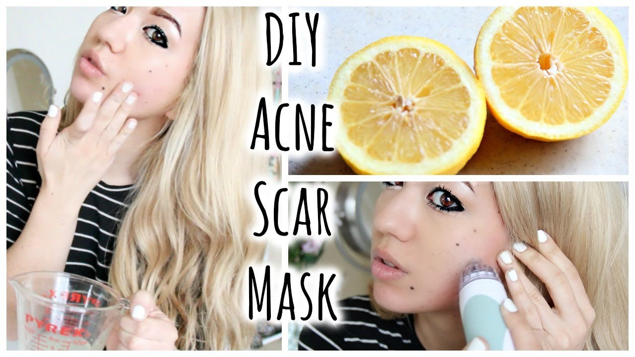 DIY Pimple Mask
 DIY Acne Scar Fading Mask Quick Acne Tips