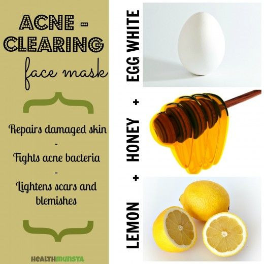 Face Mask For Acne DIY
 17 Best ideas about Homemade Acne Mask on Pinterest